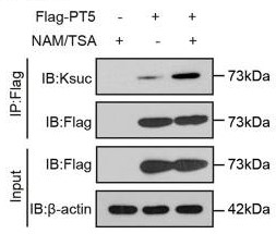 Succinylation levels of exogenous PRMT5.jpg